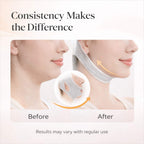 Double Chin V-Shape Face Slimming Mask